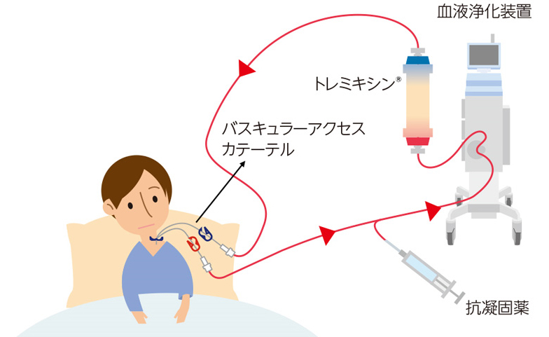 施行方法